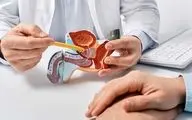 سرطان پروستات: چه چیزی پزشکان از شما پنهان می‌کنند؟