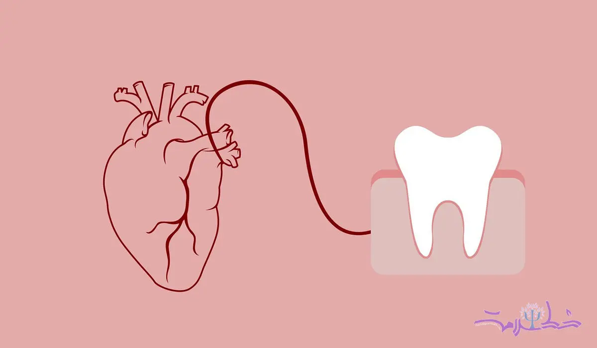 عفونت دندان چه تاثیری بر قلب دارد؟