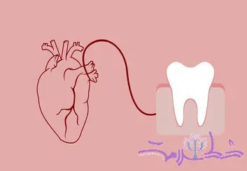 عفونت دندان چه تاثیری بر قلب دارد؟