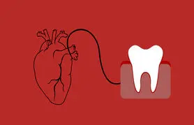 عفونت دندان چه تاثیری بر قلب دارد؟