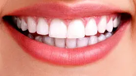 روش های خانگی سفید کردن دندان