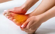 داغی پا و سوزش پا چیست و برای چه افرادی اتفاق می افتد؟