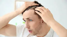 مردان با این شیوه ها دیگر موهای شان نمی ریزد + 4 تکنیک