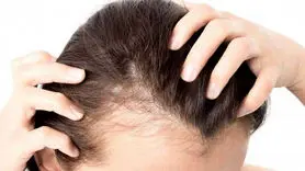 این میوه موجب رویش موهای ریخته می شود