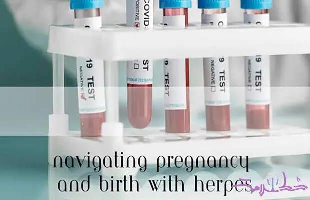 تبخال تناسلی چه تأثیری بر زندگی زناشویی دارد؟+پیامدهای روانی تبخال جنسی بر فرد، همسر و رابطه/نویسنده: دکتر مریم سامانی- روانشناس بالینی و استاد دانشگاه-