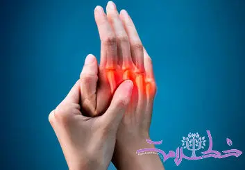 علائم آرتروز چیست؟/ این علائم نشانه آرتریت روماتوئید پنهان است