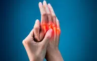 علائم آرتروز چیست؟/ این علائم نشانه آرتریت روماتوئید پنهان است