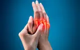 علائم آرتروز چیست؟/ این علائم نشانه آرتریت روماتوئید پنهان است