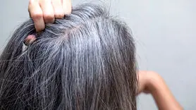 چرا موی جوانان اینقدر زود سفید می شود؟ 