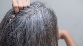 چرا موی جوانان اینقدر زود سفید می شود؟ 