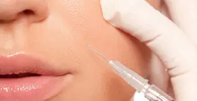  خط خنده را با ژل پر کنیم یا بوتاکس ؟