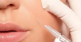  خط خنده را با ژل پر کنیم یا بوتاکس ؟