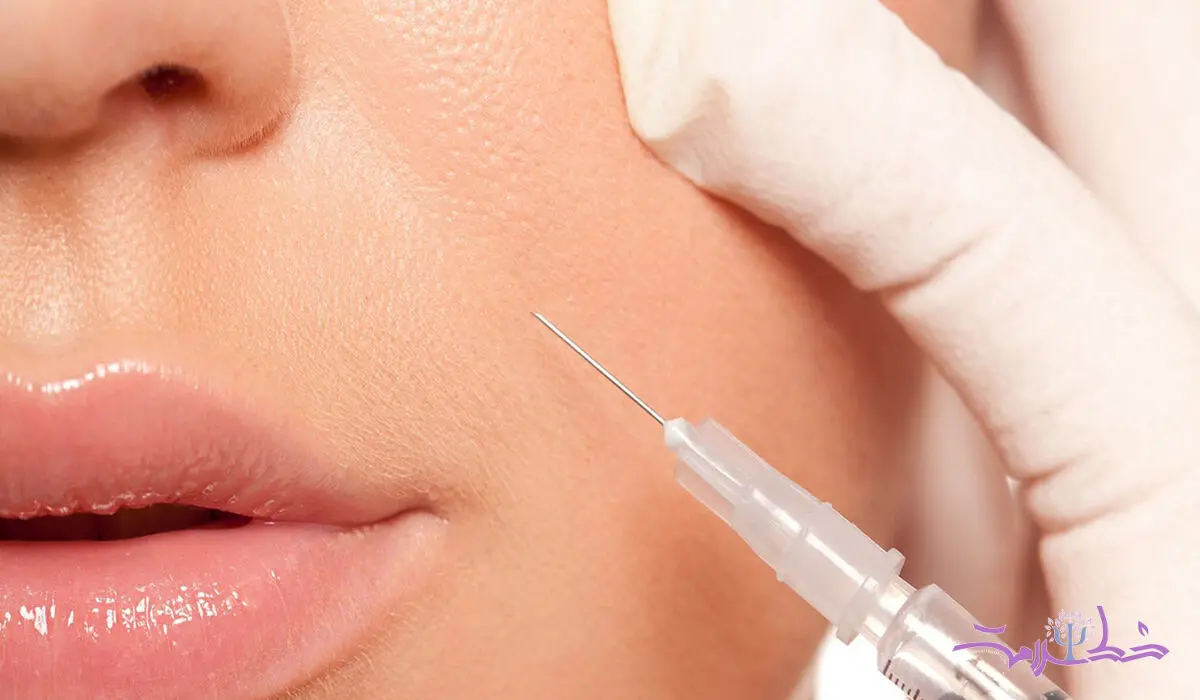  خط خنده را با ژل پر کنیم یا بوتاکس ؟