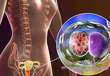چرا عفونت‌های مقاربتی سلامت روان را به خطر می  اندازند؟