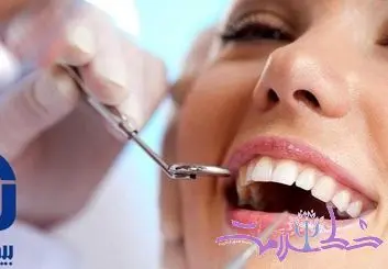 خدمات دندانپزشکی باکیفیت با بیمه آسیا در تهران