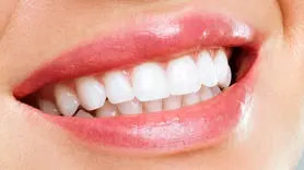 سفید کردن دندان‌های زرد در خانه با ۴ روش ساده!