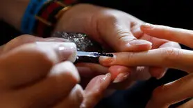 مشاهده این علامت روی ناخن مشکلات سلامتی را آشکار می کند
