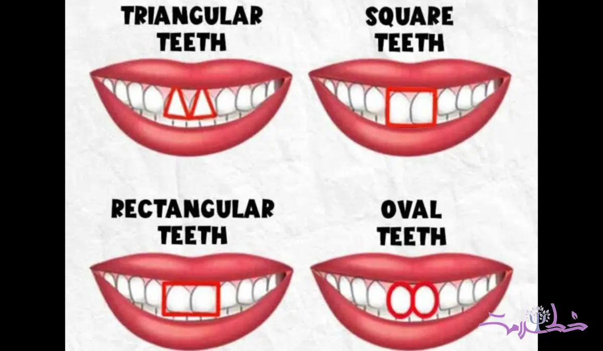 شخصیت شناسی از روی شکل دندان ها / شکل دندان ها ویژگی های شخصیتی شما را آشکار می کند