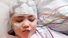 باورهای غلط و حقایق درباره صرع و تشنج: توضیحات یک متخصص مغز و اعصاب
