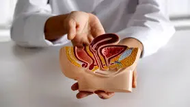 رابطه سرطان روده بزرگ با یک باکتری در دهان