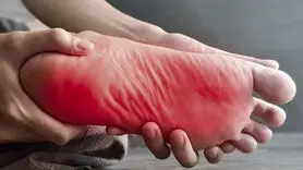 چگونه در گرما از پاها مراقبت کنیم؟