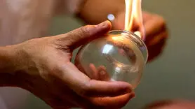  قبل از حجامت چه نکاتی را باید در نظر گرفت ؟