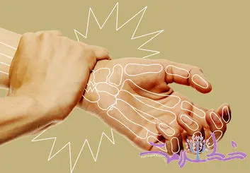 راه شناسایی پوکی استخوان + چگونه قبل از شکستگی جلو آن را بگیریم؟