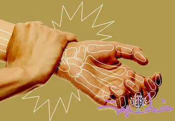 راه شناسایی پوکی استخوان + چگونه قبل از شکستگی جلو آن را بگیریم؟