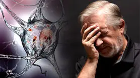 آلزایمر و زوال عقل دیررس چه تفاوتی دارد؟