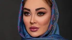 تحلیل تغییرات الهام‌ حمیدی تنها بازیگری که با تزریق زیباتر شد