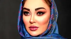 تحلیل تغییرات الهام‌ حمیدی تنها بازیگری که با تزریق زیباتر شد