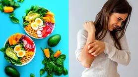 رژیم غذایی مناسب برای پسوریازیس: چه بخوریم و چگونه از تشدید آن جلوگیری کنیم؟