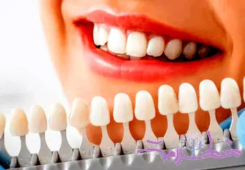 آیا سفید کردن دندان‌ها برای سلامت روان شما مفید است؟