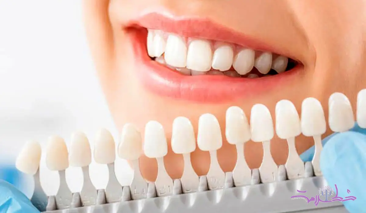 آیا سفید کردن دندانها برای سلامت روان شما مفید است؟