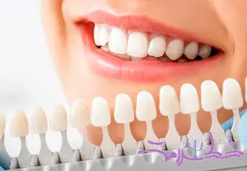 آیا سفید کردن دندان‌ها برای سلامت روان شما مفید است؟