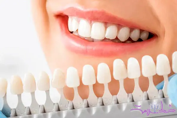 آیا سفید کردن دندان‌ها برای سلامت روان شما مفید است؟