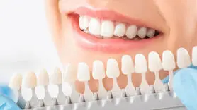 آیا سفید کردن دندان‌ها برای سلامت روان شما مفید است؟