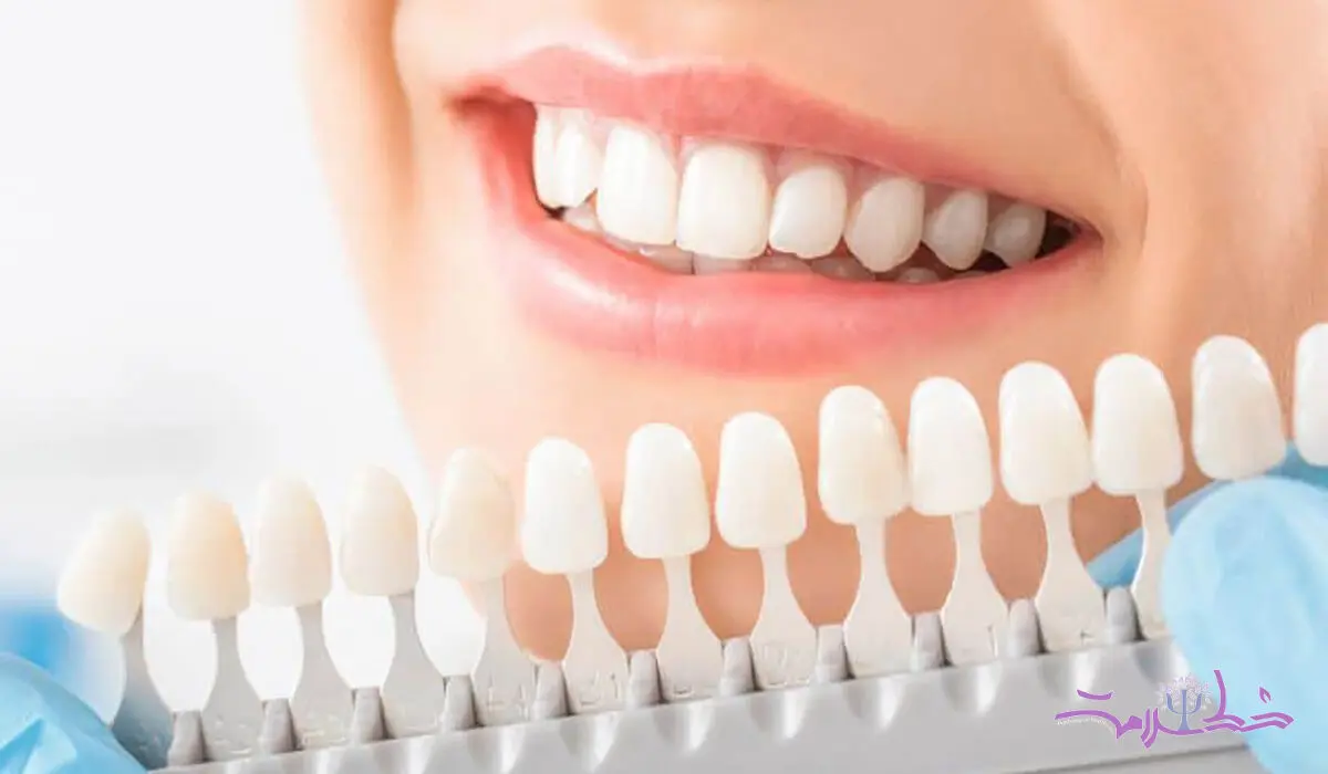 آیا سفید کردن دندان‌ها برای سلامت روان شما مفید است؟