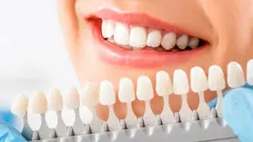آیا سفید کردن دندان‌ها برای سلامت روان شما مفید است؟