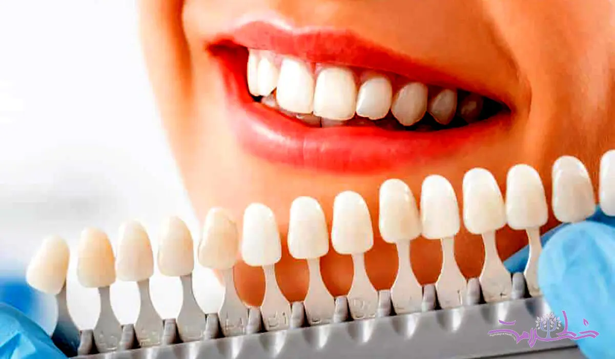 آیا سفید کردن دندان‌ها برای سلامت روان شما مفید است؟