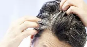 این 4 ویتامین را کم داشته باشید ریزش مو و سفیدی حتمی است