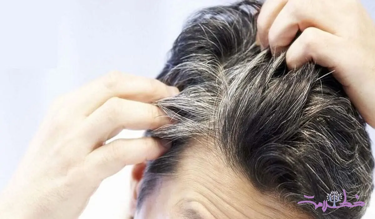 این 4 ویتامین را کم داشته باشید ریزش مو و سفیدی حتمی است