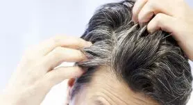 این 4 ویتامین را کم داشته باشید ریزش مو و سفیدی حتمی است