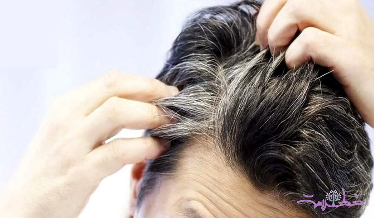 این 4 ویتامین را کم داشته باشید ریزش مو و سفیدی حتمی است