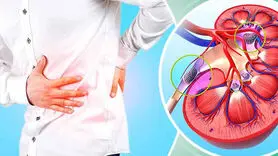 این دو نوشیدنی سنگ کلیه را سریع حل می کند