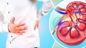 این دو نوشیدنی سنگ کلیه را سریع حل می کند