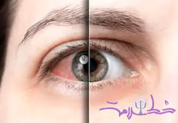 وقتی بدن به خود خیانت می‌کند این بیماری سر و کله اش پیدا می شود