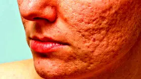 پوست تان را با این شیوه ها آینه کنید+ راهکار