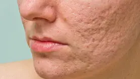 پوست تان را با این شیوه ها آینه کنید+ راهکار