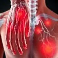 دشمن روماتیسم، راهنمای شناخت علائم و انتخاب بهترین دکتر روماتیسم